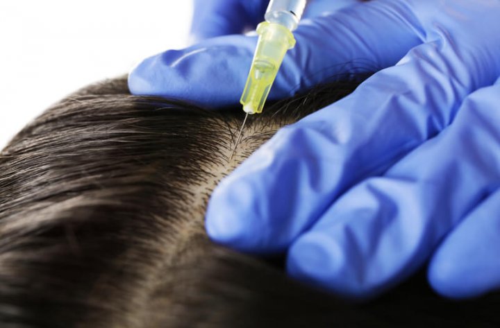 Haartransplantation | © panthermedia.net /belchonock
